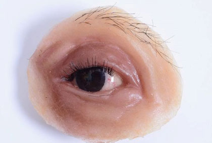 Ocular-Prosthesis